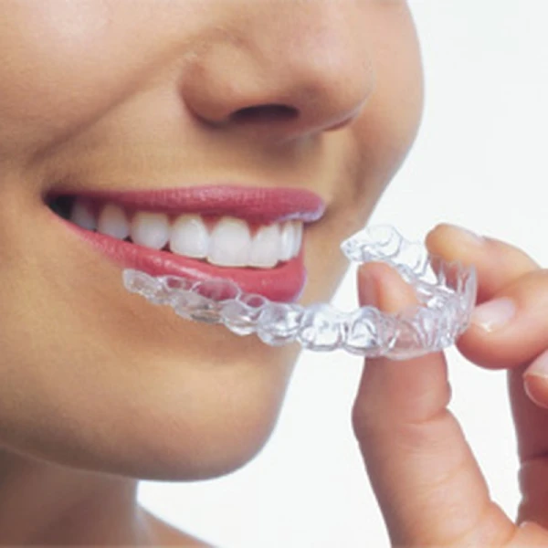 Invisalign Marketing