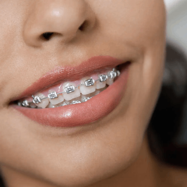 Orthodontist Marketing