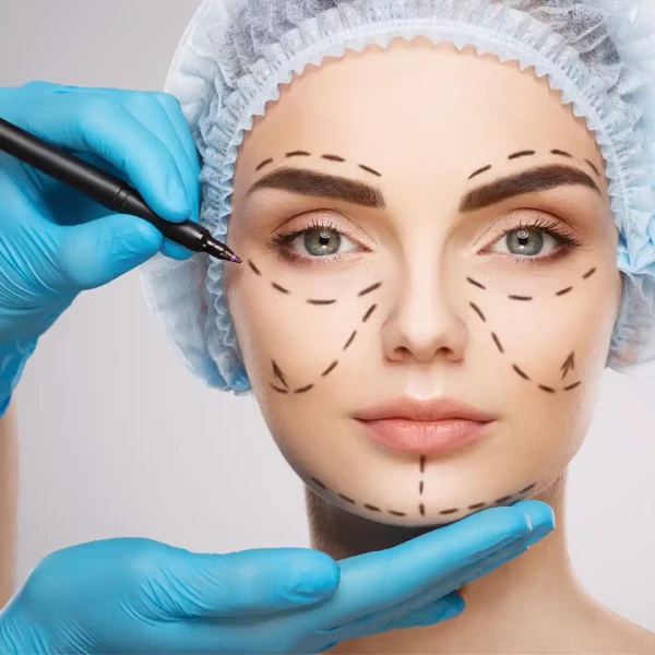 Plastic Surgery Marketing